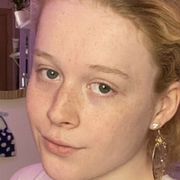 allie0tfree Nahé