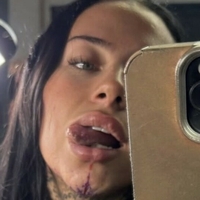 Charleymcmahon Nahé