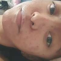 xsugarvulpesx Nahé